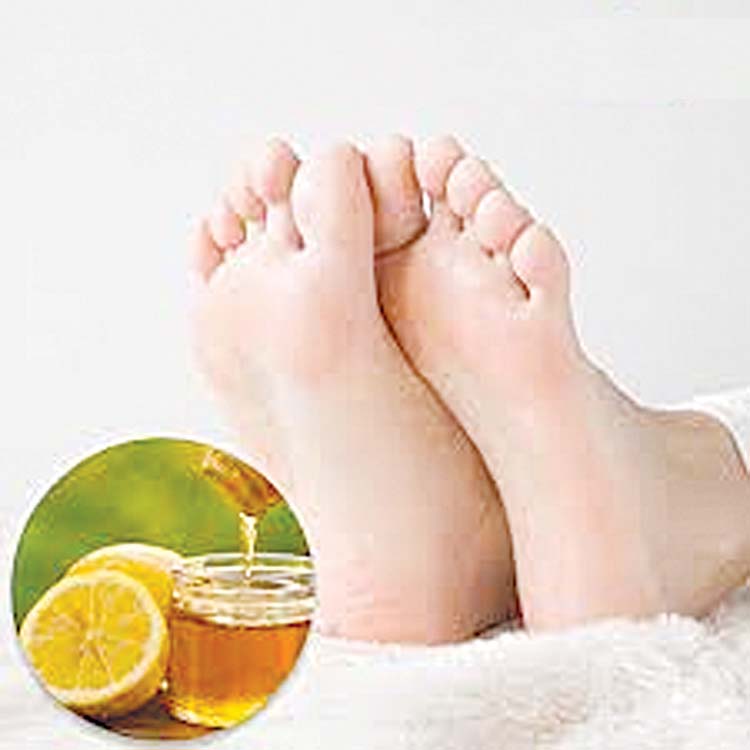 Amazon.com : MONA Natural Foot Balm for Dry Cracked Feet & Heels |  Moisturizing Foot Cream for Athletes | Callous Repair & Foot Odor Treatment  (Eucalyptus & Lemon, 2.0 Oz (Pack of